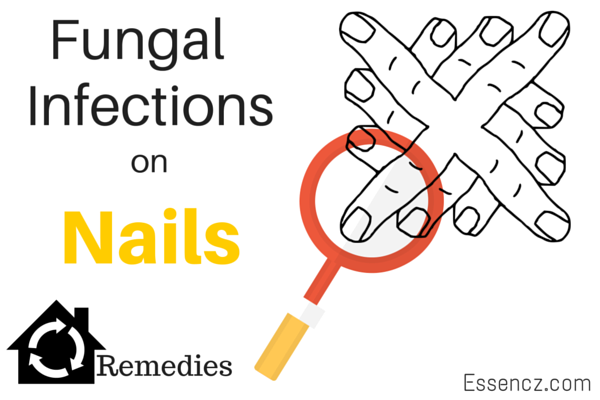 Fungal infections