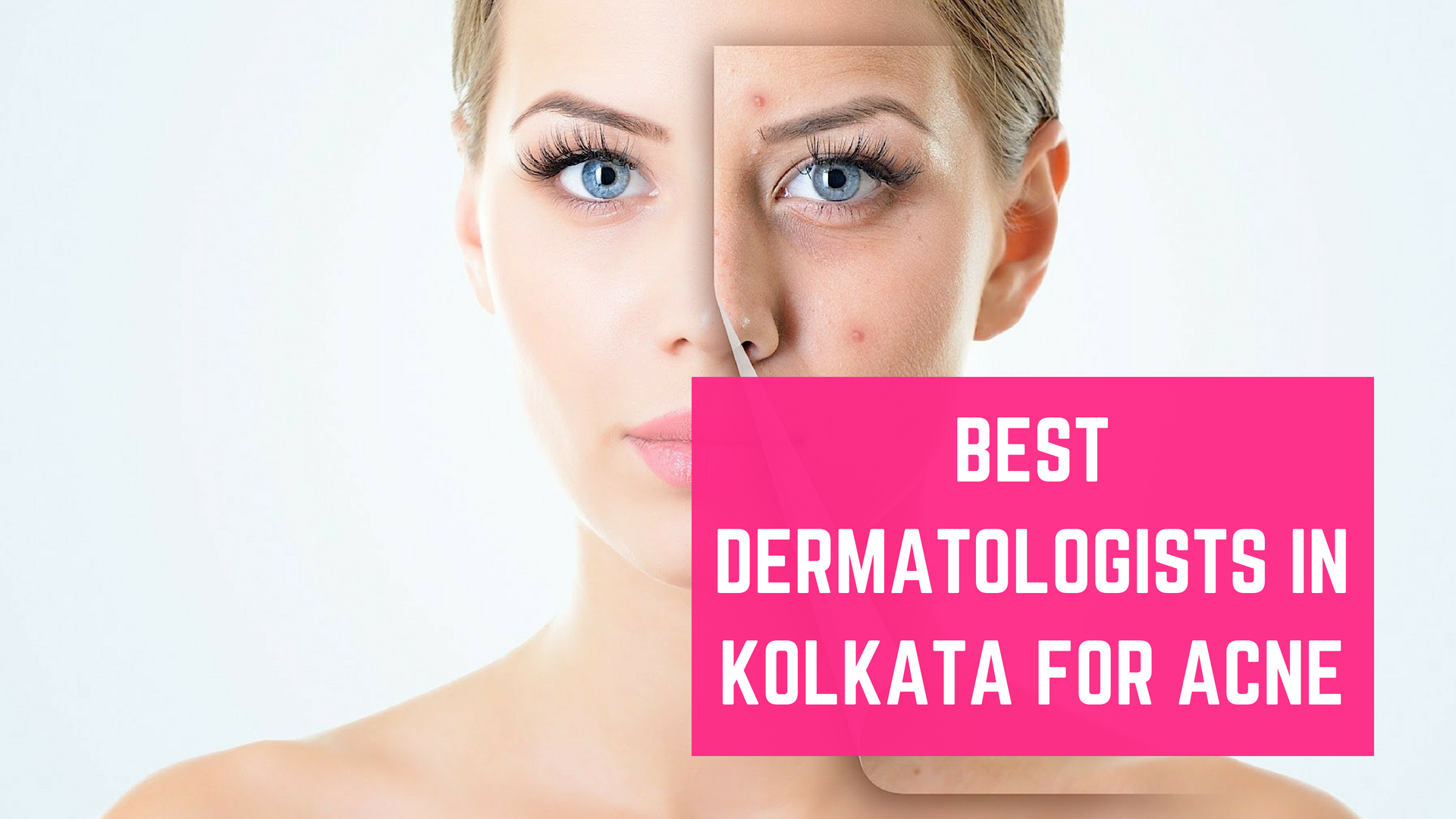 Top 10 Best Dermatologists in Kolkata for Acne - Essencz