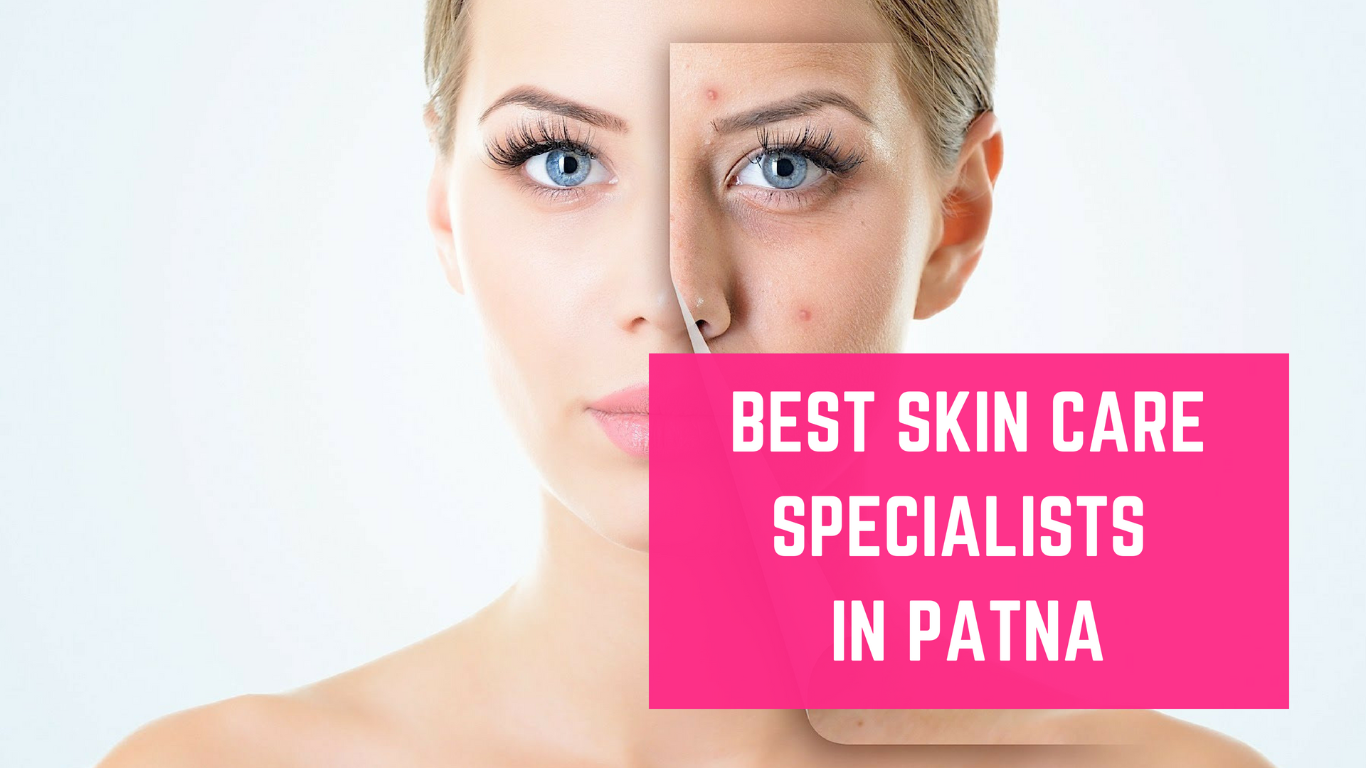 Top 10 Best Skin Specialists in Patna Essencz