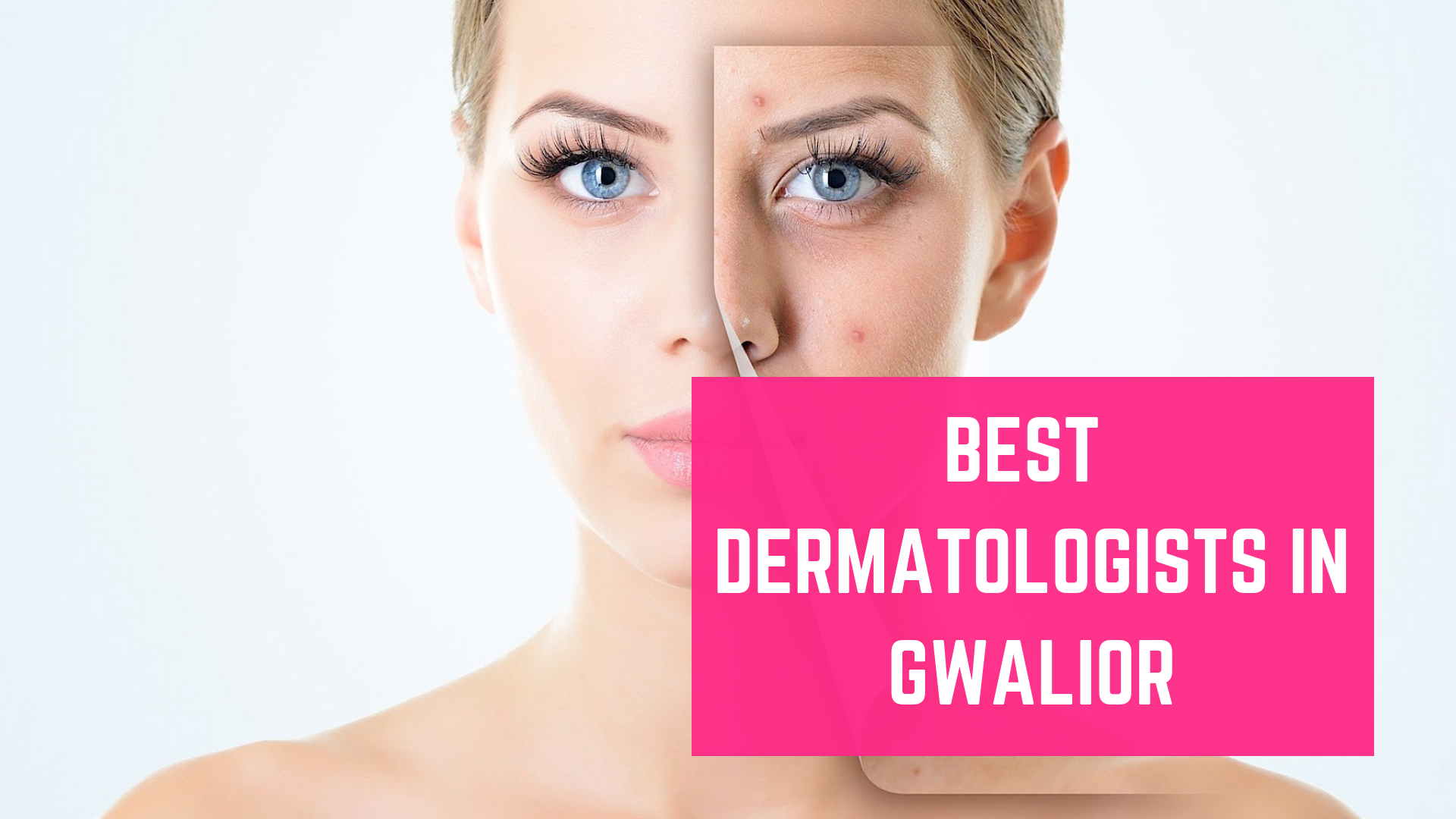 Top 10 Best Dermatologists in Gwalior - Essencz