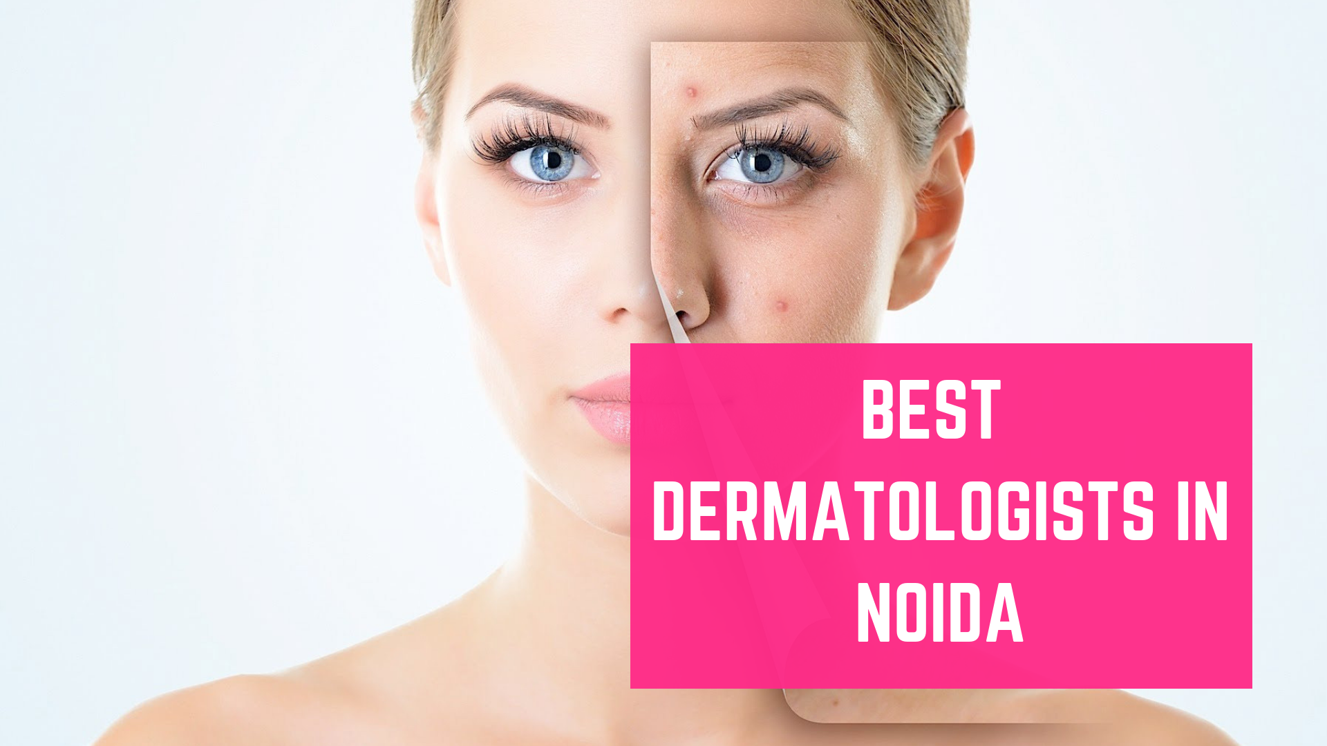 Top 10 Best Dermatologists in Noida - Essencz
