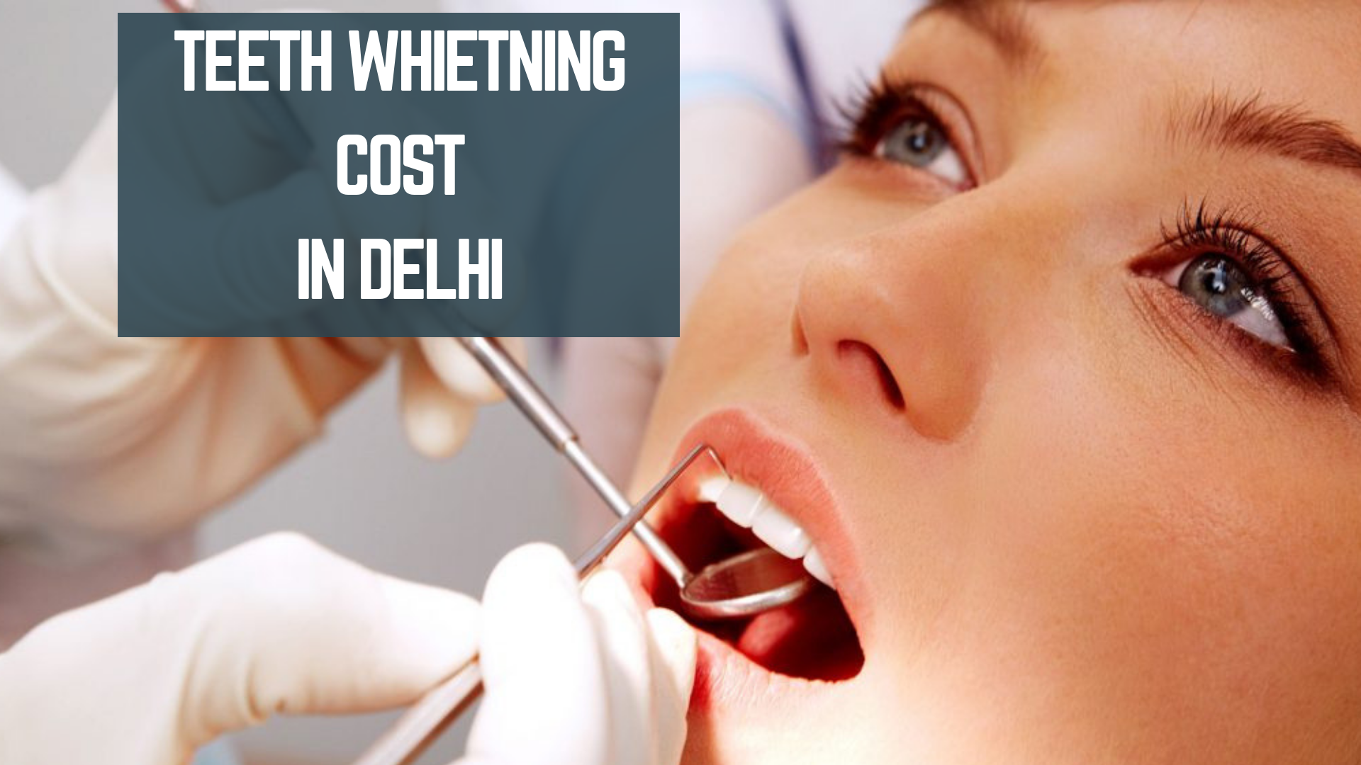 Teeth whitening cost pune