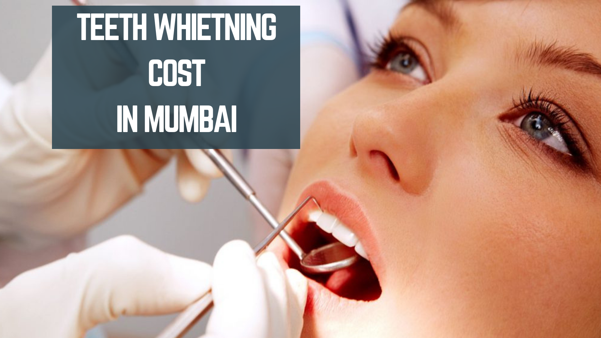 Teeth Whitening Cost in Mumbai- 2019 - Essencz